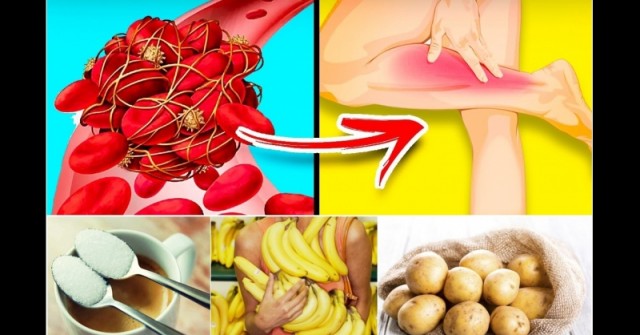 10 коварни продукта, които опасно сгъстяват кръвта и предизвикват тромби – ядем ги ежедневно: