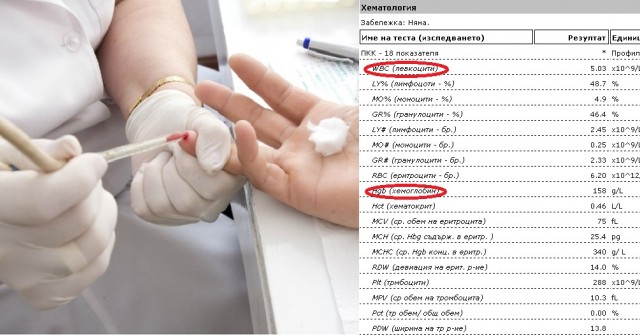 Последни новини Тези 9 кръвни показатели, показват всичко за здравето ни: ето как да разчетем правилно кръвната картина!