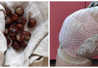 Как да си помогнеш с ШЕПА кестени при силни болки в ставите и мускулите (4 народни рецепти)