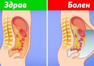 8 признака на чернодробно заболяване, които показват, че трябва да посетите лекар веднага