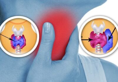 Колко вредна е соята и пластмасата върху щитовидната жлеза?