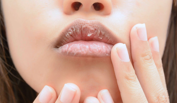 Лесни съвети за красиви и здрави устни