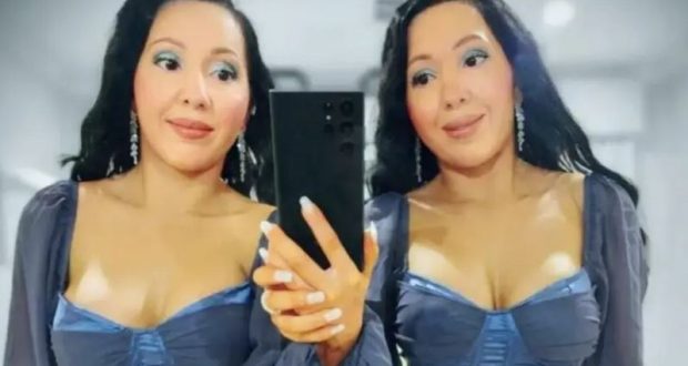 Еднояйчни близначки шокираха света