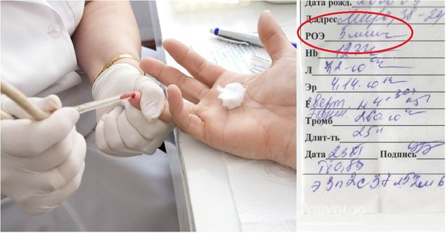 Кръвните показатели разкриват всичко за здравето ви – научете се как да ги разчитате ТУК!